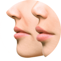 Cosmetic Fillers Services