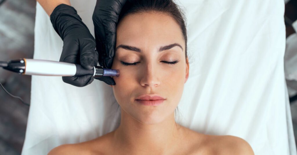 microdermabrasion, microneedling