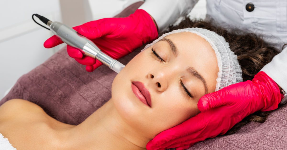 Microneedling benefits, treatments, results