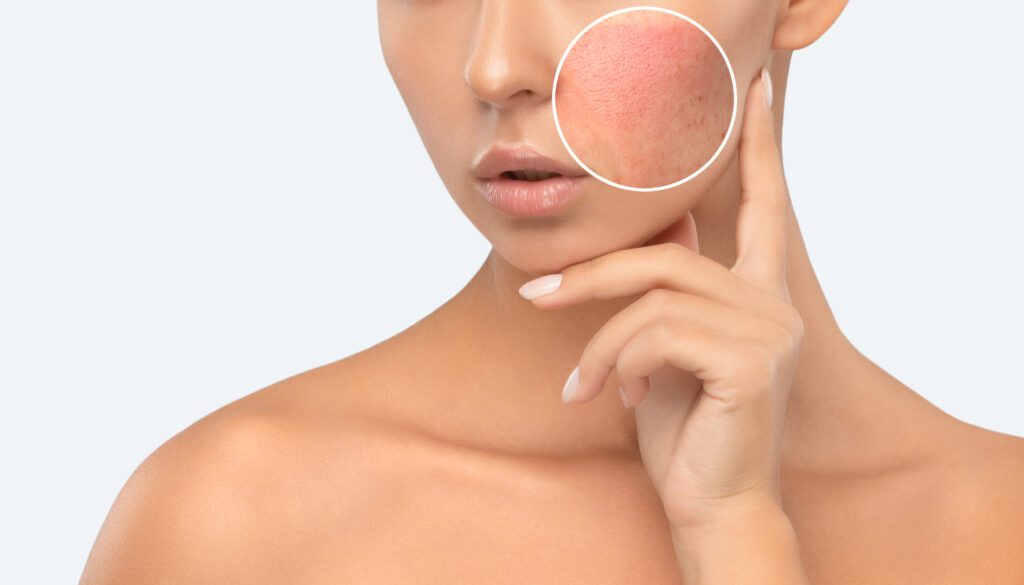 9 Laser Procedures: Revolutionizing Skincare &Amp; Rejuvenation