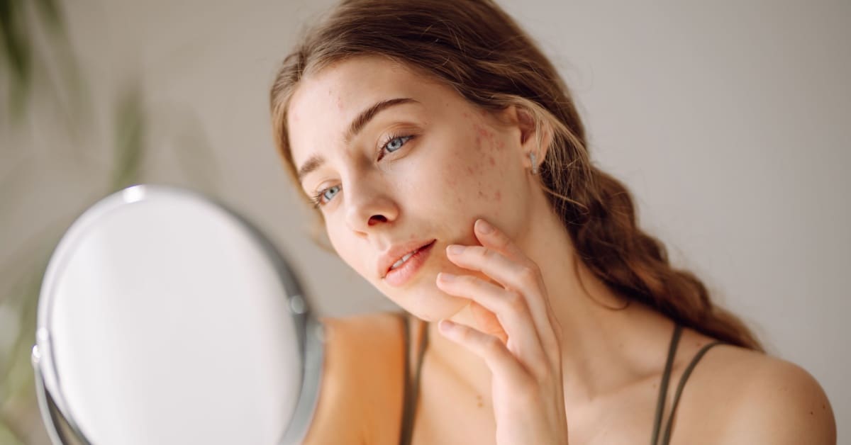 woman looking in mirror, wondering is it rosacea vs. acne, eczema or lupus